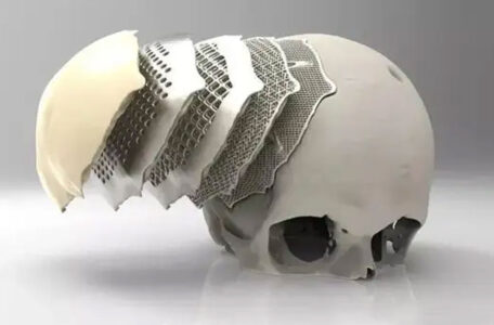PEEK Is The Manufacturing Material For The Next Generation Of 3D Printed Dental Implants